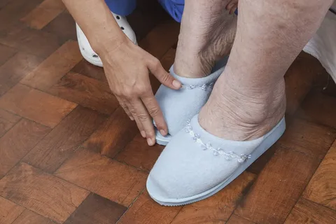 medical shoes for swollen feet